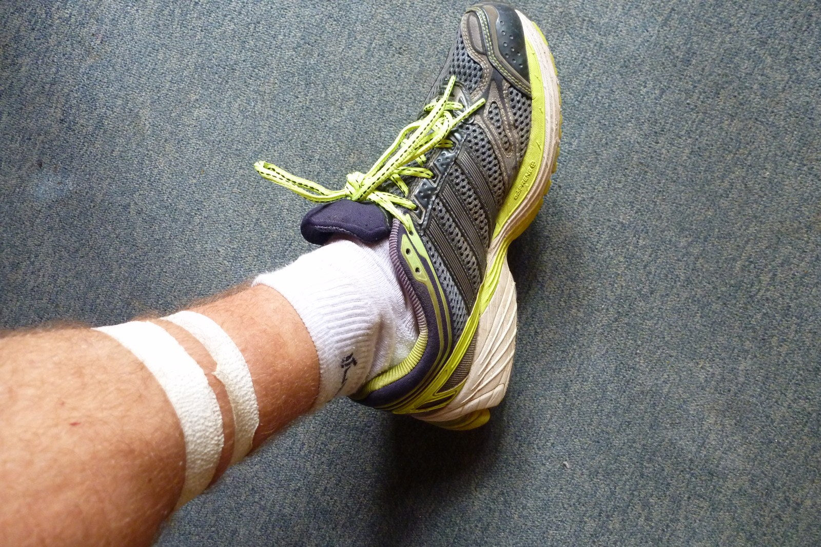 Douleur au mollet en course à pied : comment prévenir et gérer son apparition ?